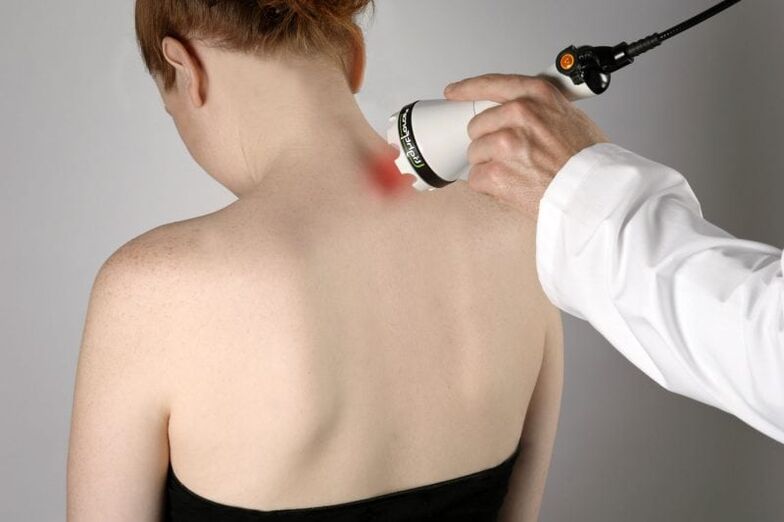 Tratamento con láser da osteocondrose cervical en mulleres